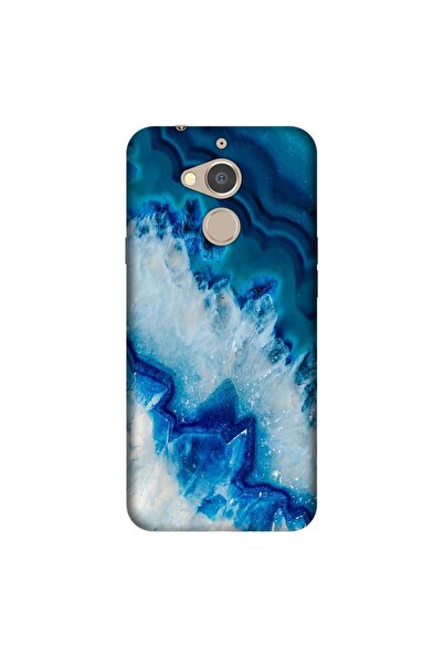 General Mobile Gm 8 Uyumlu   Kılıf 0.4mm Lazer Kesim Silikon Kapak Koyu Ametist