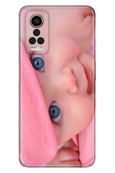 General Mobile Gm 22 Pro Case 0.4mm Laser Cut Silicone Cover Maviş