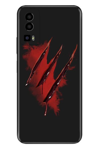 General Mobile Gm 23 - Gm 23 Se Case Silicone Patterned Illustrated Sharp Wound