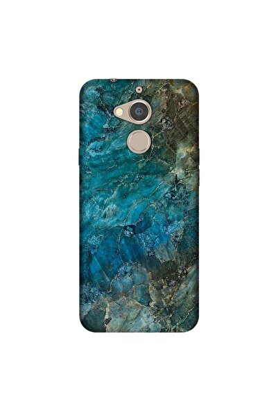 General Mobile Gm 8 Kılıf 0.4mm Lazer Kesim Silikon Kapak Mavi Mermer