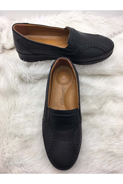 SPECIAL SHOES FOR ÇİĞDEM BLACK REAL LEATHER BONE PROTRUSION