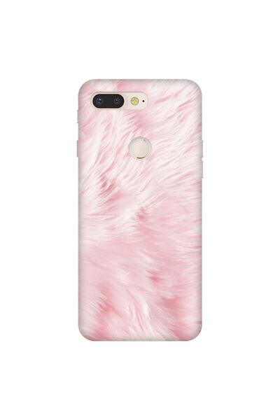General Mobile Gm 9 Pro Uyumlu Kılıf 0.4mm Lazer Kesim Silikon Kapak Pembe Tüy