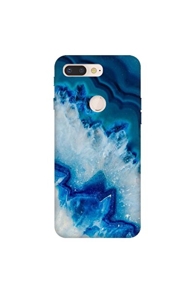 General Mobile Gm 9 Pro Uyumlu Kılıf 0.4mm Lazer Kesim Silikon Kapak Koyu Ame...