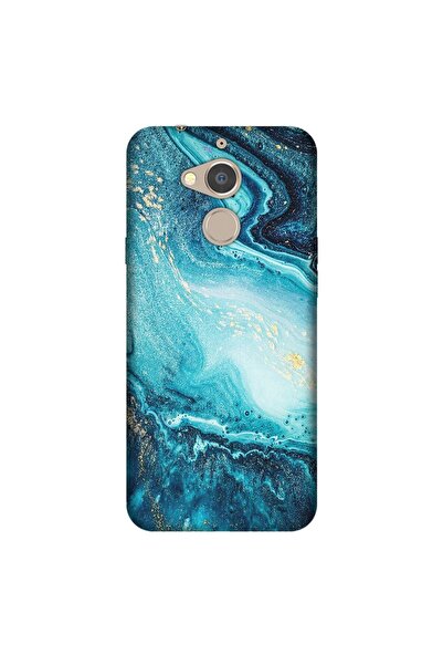 General Mobile Gm 8 Uyumlu Kılıf 0.4mm Lazer Kesim Silikon Kapak Işlenmiş Ame...