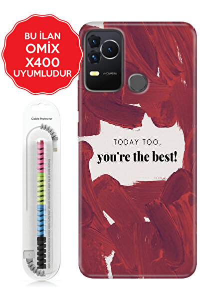 omix X3 X5 X6 X7 X300 X400 X500 X600 X700 Kılıf Vip Stok Kodu:Today