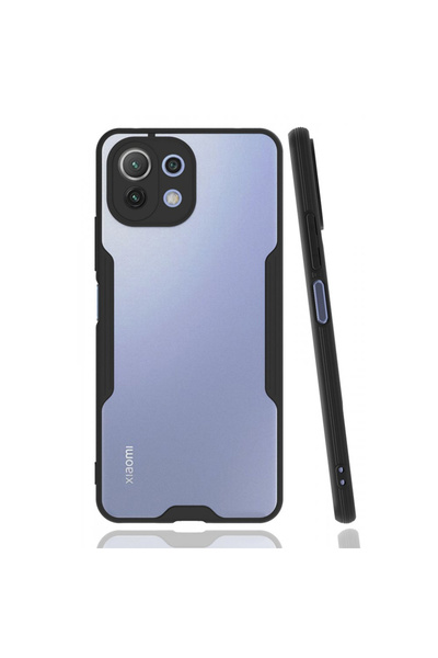 Nettech Xiaomi Mi 11 Lite Uyumlu Platin Seri Arka Koruma Kılıf - Siyah
