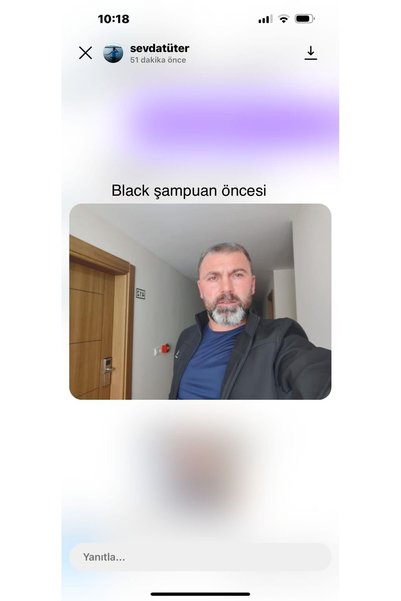 EGŞ COSMETİCS Black white pigment şampuan