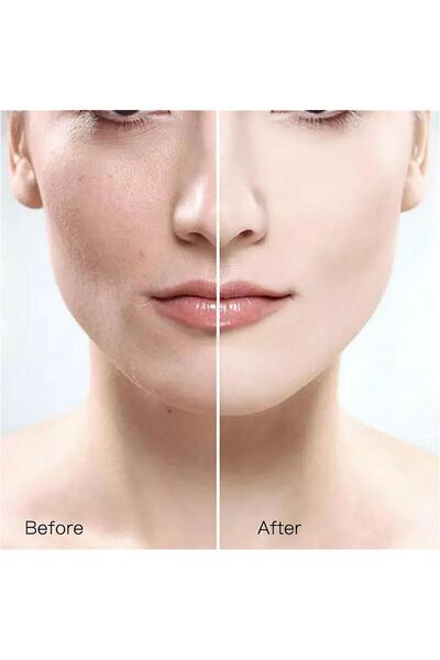 GELLO Cilt Beyazlatıcı Leke Kremi Whitening Beyazlatıcı Krem