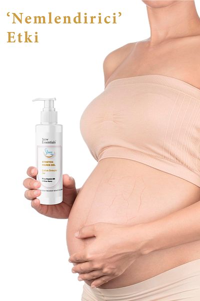 New Essentials Stretch Marks Gel Anti Stretch Mark Care Gel 200 ml