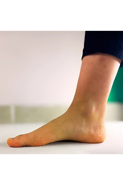 MediclinicOrtopedi Ortopedik ve Anatomik Ayak Tabanlığı Düz Taban İçin