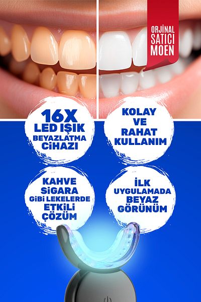 MOEN Professional Teeth Whitening Set 16 Leds