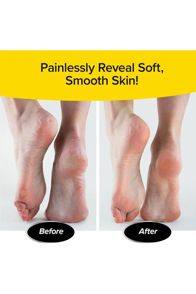 ANI OFİS KIRTASİYE A K Pratik Ayak Tabanı Bakım Törpüsü Topuk Nasır Temizleme Rende Nasır Temizleme