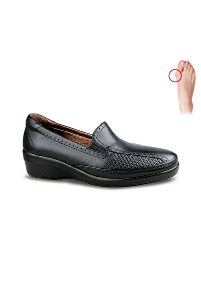 Ceyo Women's Bone Protrusion and Heel Spur Orthopaedic Sole Shoes 9920
