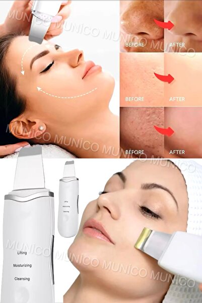 Genel Markalar 4'ü 1 Arada Cilt Spatula Yüz Temizleyici Spatula, Derin Temizleyici Siyah Nokta Temizleyici Gözenek