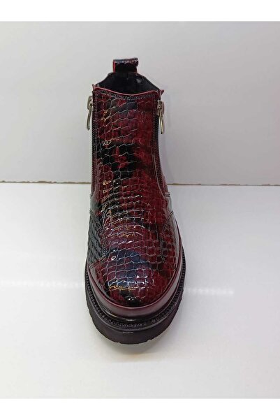 Espy Ayakkabı Kadın Rugan deri Ortopedik Bot