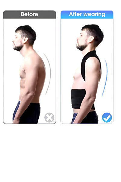 figiza Orthopedic Shoulder and Back Waist Corset - Magnetic Upright Posture with Underwire, Anti Humpback Cyphosis Scoliosis