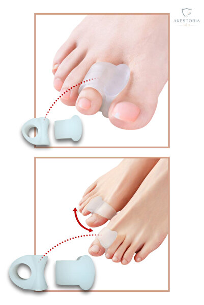 Genel Markalar Çift Yüzüklü Parmak Arası Makara Baş Parmak Şekil Düzeltici Fc...