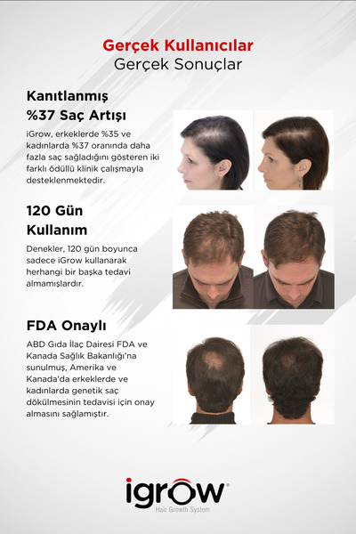 Apira Science Inc Igrow Lazerli Saç Çıkartma Ve Dolgunlaştırma Cihazı (fda Onaylı)