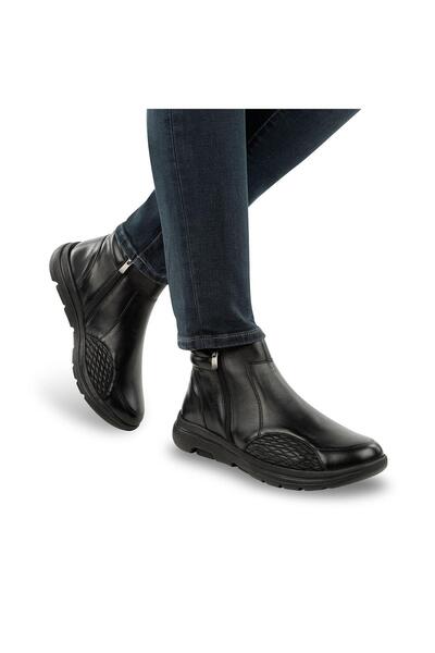 Muya Helix Anatomik Taban Topuk Dikeni Hakiki Deri Halluks Valgus Kemik Çıkıntısına Uygun Erkek Bot