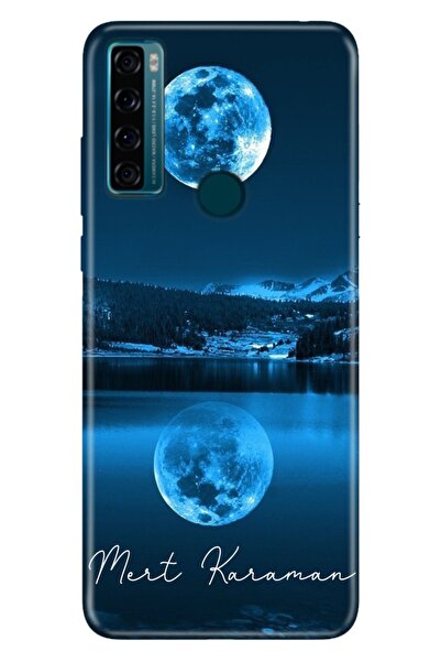 TCL 20 SE Uyumlu Kılıf İsim Yazılı Kişiye Özel Silikon Model-17