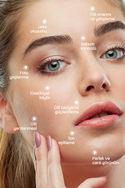 Quality Life 10% Niacinamide Cilt Serumu Gözenek Sıkılaştırıcı 1% ZinC Leke Akne Sivilce Sebum Karşıtı Serum