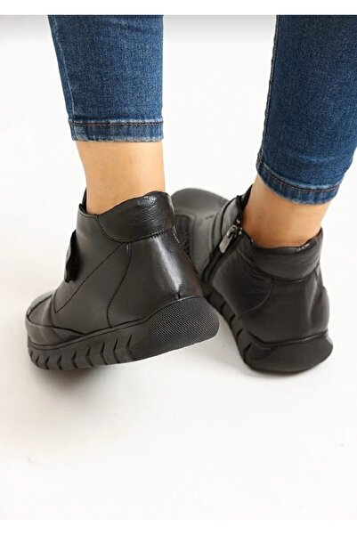 Özkan Ayakkabı Kemik Çıkıntısına Özel Hakiki Deri Cırtlı Fermuarlı Siyah Kaymaz Kaucuk Taban Anne Bot