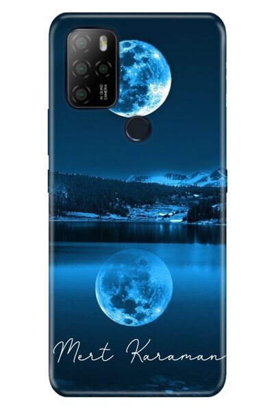 omix X300 - X500 Uyumlu Kılıf İsim Yazılı Kişiye Özel Silikon Model-17