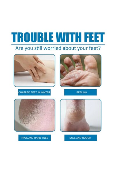 KIMJISOON Peelable Foot Peeling Mask for Dead Skin and Cracks