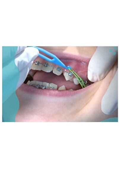 First Class Diş Teli Lastiği 1/4 3.5oz Heavy Ağıziçi Lastik-Ortodonti Lastiği Ve Takma Aparatı