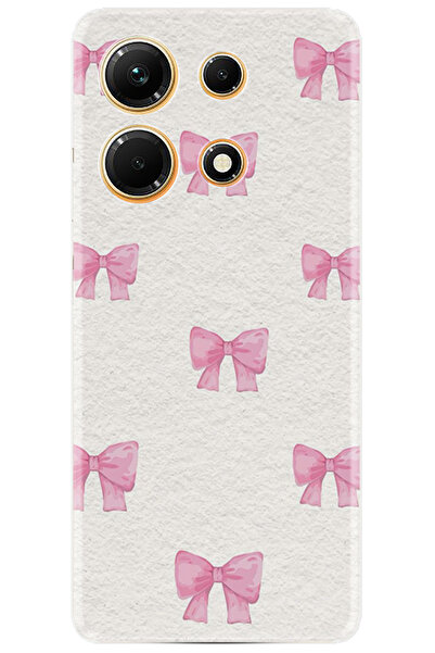 Arvencase حافظة انفينيكس نوت 30 حافظة مطبوعة عالية الدقة حماية عالية - /Bests...