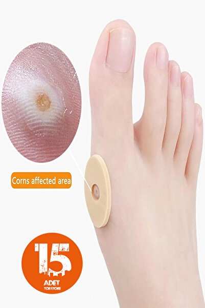 Tor Store Ayak Nasır Yastığı Bandı Ayakkabı Vurma Önleyici Koruyucu Delikli P...