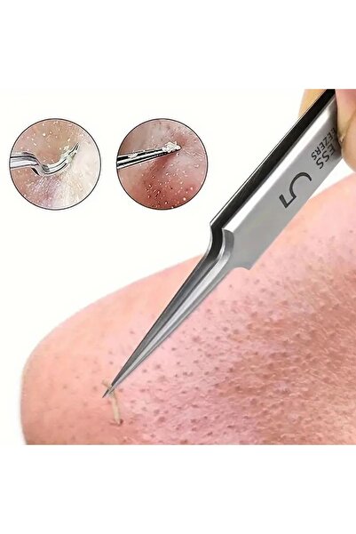 Mucizelerevi Paslanmaz Çelik Siyah Nokta Ve Leke Temizleyici Seti  Çıkarma Araçları Siyah Nokta Cımbızı