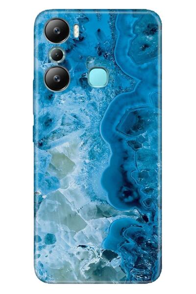 Cekuonline Infinix Hot 20I Case Silicone Patterned Illustrated Uv Cover Blue ...