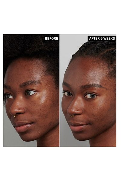 THE INKEY LIST Hyperpigmentation Night Treatment - Skin Equalizing Night Care 30 ml