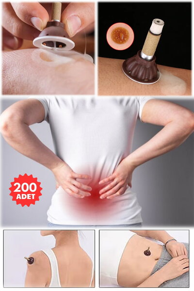 Munico 200 Adet Pelin Otu Masaj Stickerı Dumansız Rulo Moxibusti Tüpü Masaj A...