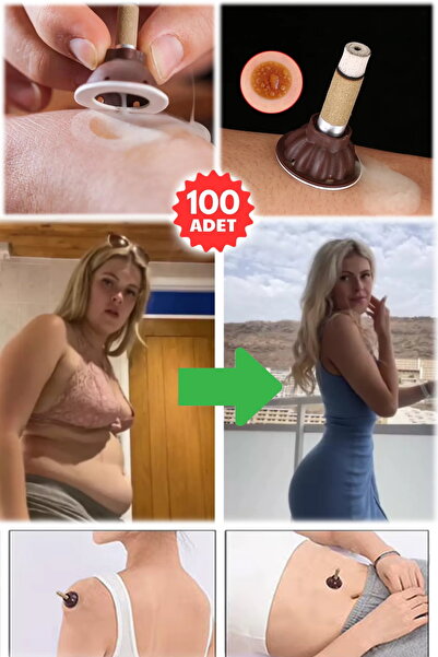 Munico 100 Adet Zayıflamayı Daha Sağlıklı Bir Şekilde Hızlandırın Gelişmiş Ki...