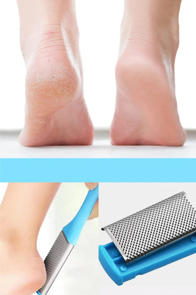 bloomplus Nasır Ayak Ölü Deri Rendesi Ponza Etkili 2 Yüzey Ve Boşaltıla Bilir İç Hazneli bp69