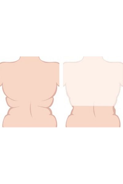 Yeniİnci Corse for Arm and Back