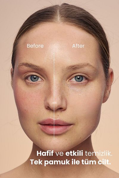 MATSU Micellar Water – Vegan & Moisturizing Makeup Cleansing Water