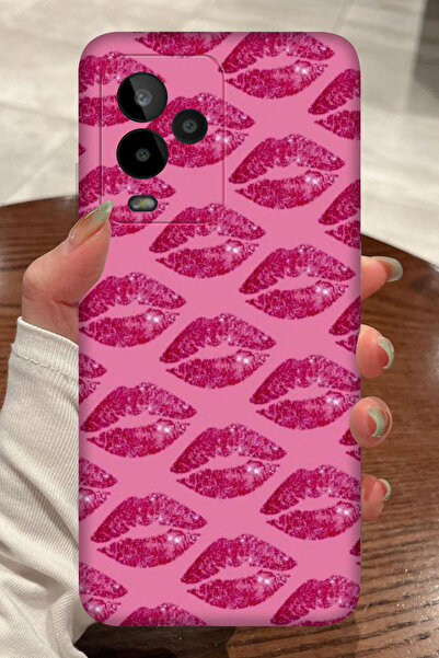 General Mobile GM 24 Pro Pembe Dudak Desenli Kamera Korumalı HD Baskılı Silikon Kılıf