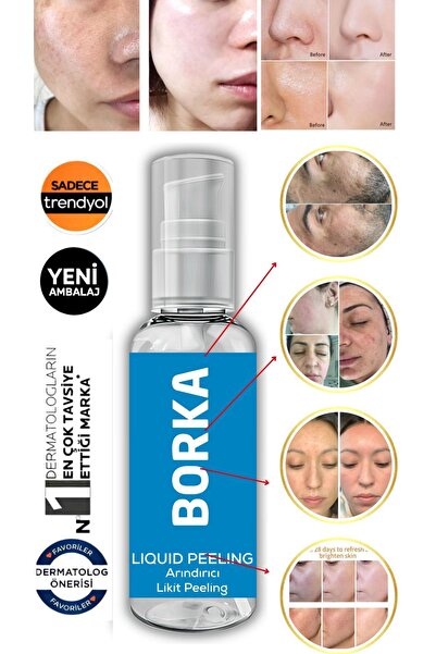 BORKA Anında Soyucu Krem Peeling Ölü Deri Arındırıcı Yenileyici Gözenek Aydın...