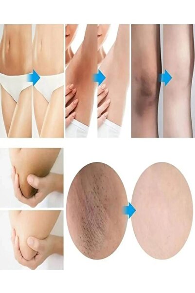 Mardinal 3 Lü Beyazlatıcı Vip Seti Beyazlatma Kremi Sabunu Ve Serumu