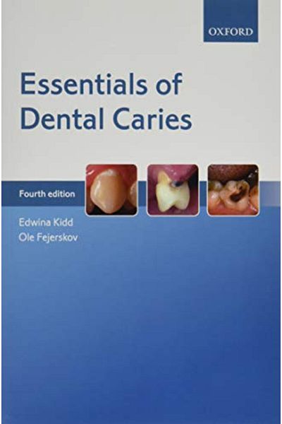 OXFORD UNIVERSITY PRESS Essentials Of Dental Caries