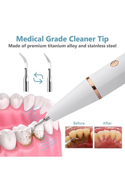 Şimdi Trend Şarjlı Ultrasonic Titreşimli Diş Tartar Temizleme 3 Modlu LED Işı...