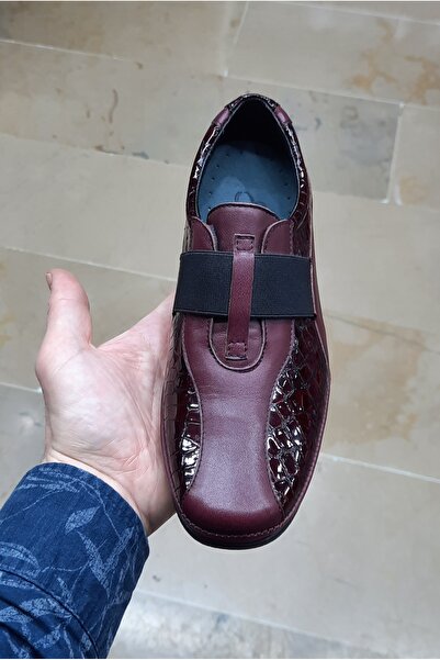 EBRU COMFORT Women's Indoor-Outdoor Genuine Leather Orthopedic Padded Heel Patent Leather Mother's Shoes