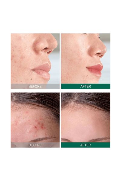 Some By Mi AHA. BHA. PHA 30 Days Miracle Starter - 4 Piece