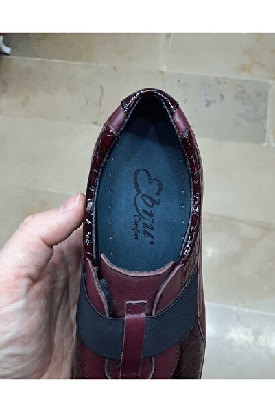 EBRU COMFORT Women's Indoor-Outdoor Genuine Leather Orthopedic Padded Heel Patent Leather Mother's Shoes