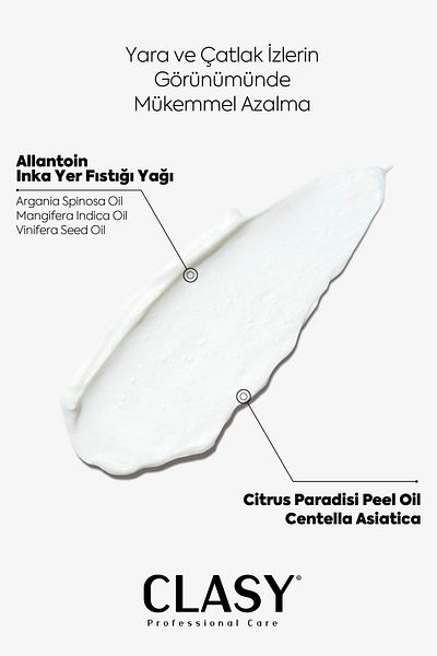 Clasy Care Scar and Stretch Mark Appearance Reducing and Excellent Preventive Cream