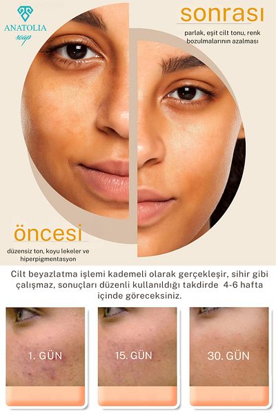 Anatolia Soap Kojic Acid Turmeric Soap 3 Pcs Collagen Effect on the Skin Hyaluronic