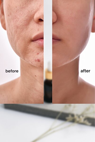 KAİZEN Ten Dengeleyici Beyazlatıcı Krem Ve Sabun Seti